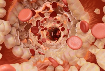 glp 1 and libido GLP-1 receptor agonists may dampen libido, likely through brain pathways  tied to appetite and reward, though mechanisms remain unclear. Emerging  data suggest serotonin receptor effects may play a role, but clinicians note