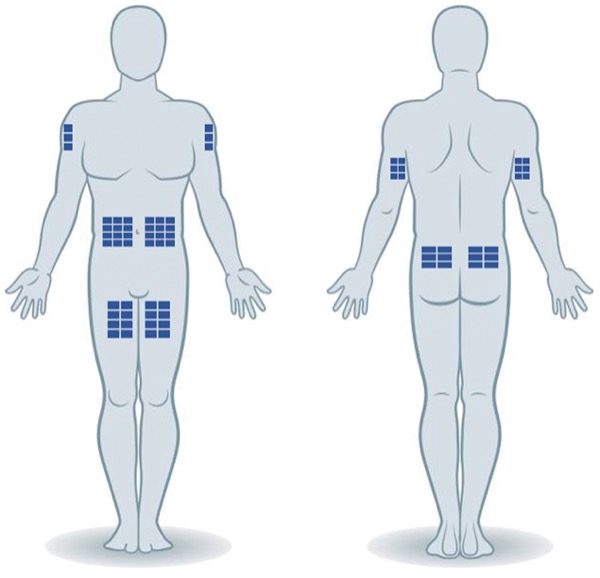 Scig Subcutaneous Immunoglobulin Therapy Fundamentals