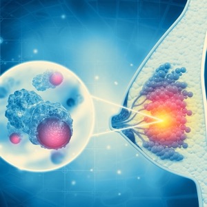 best glp 1 with least side effects How To Manage GLP-1 Side Effects